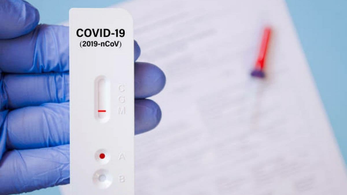 В Украине за сутки почти 17 тысяч новых случаев COVID-19