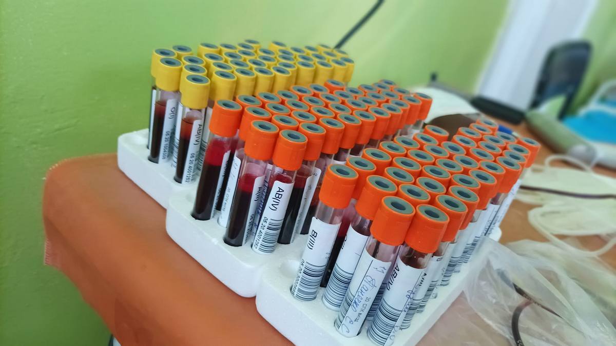 У ВООЗ заявили, що мавпяча віспа отримає нову назву: причина
