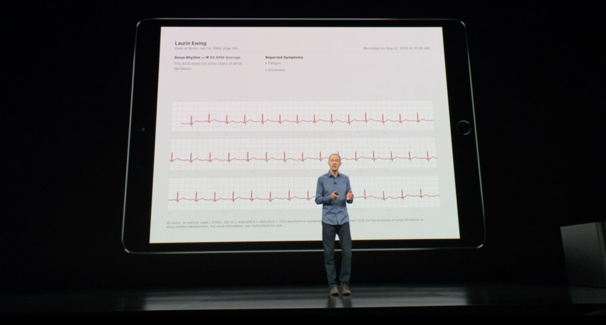 Apple Watch S4 может делать электрокардиограмму