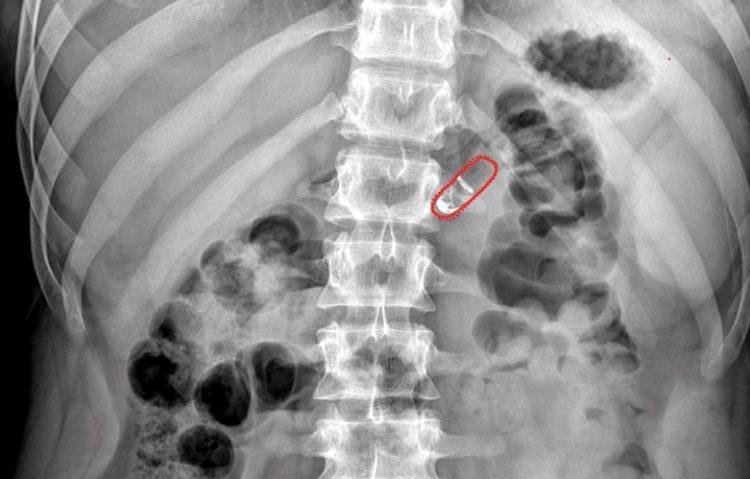 Все элементы капсулы созданы из биоразлагаемого материала