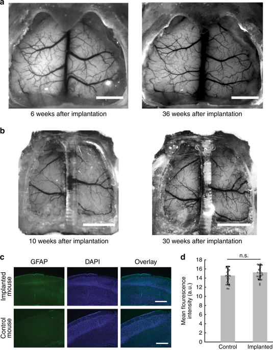 3D-printed transparent