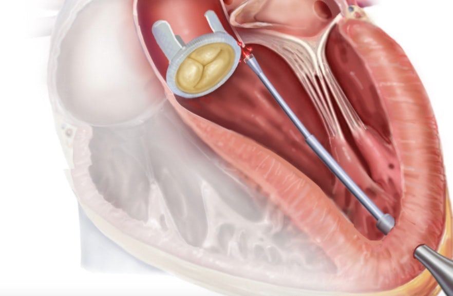 Главной особенностью данной медицинской разработки является отдельный модуль искусственного интеллекта