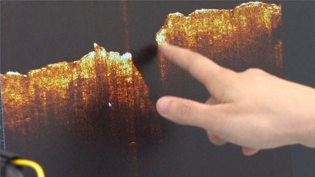 Система оптической когерентной томографии создает детальные 3D-изображение структуры кожи под поверхностным слоем