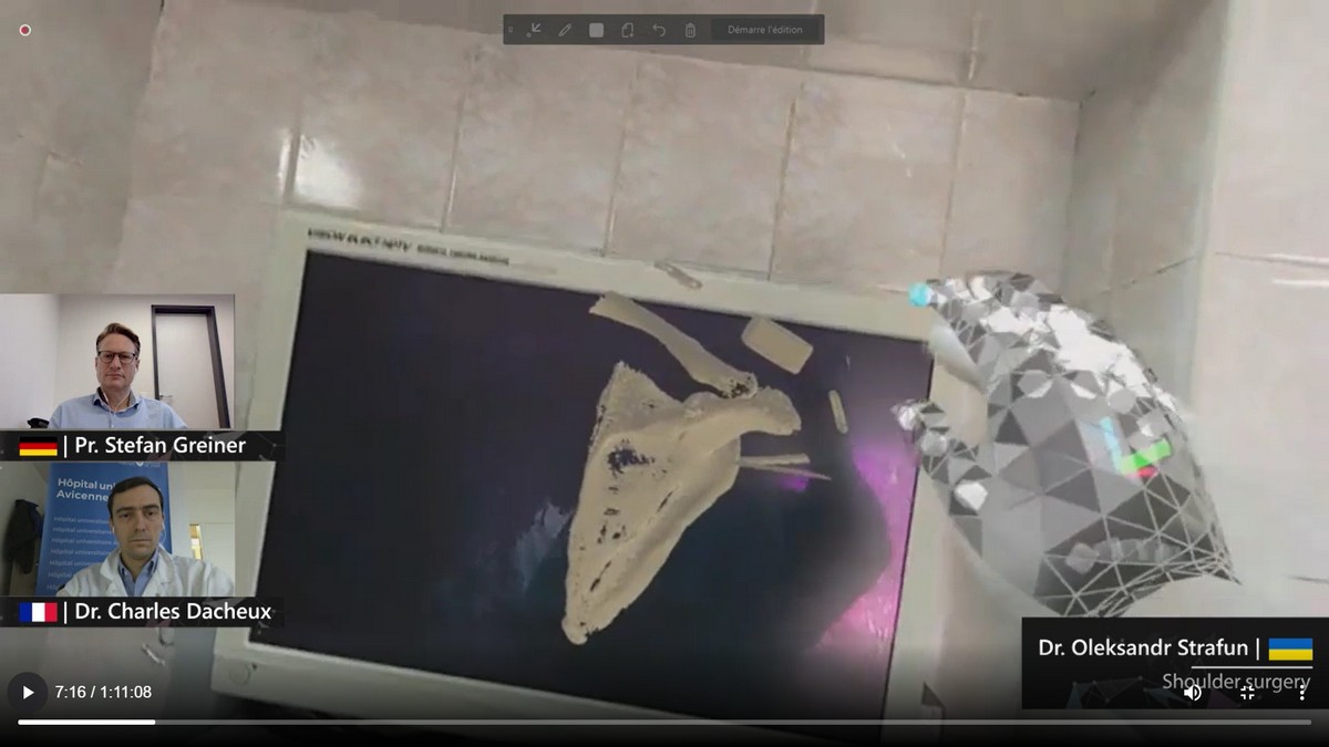 Украинский хирург-ортопед провел операцию по реверсивному депротезированию плечевого сустава с помощью гарнитуры Microsoft HoloLens2